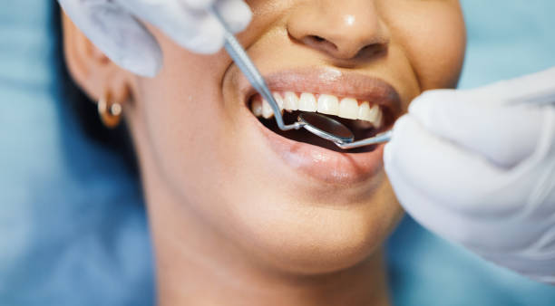 Best 24-Hour Emergency Dentist in Black Point Green Point, CA