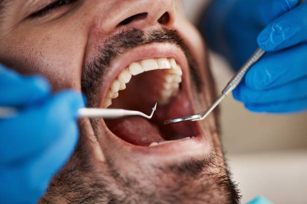 Best Emergency Tooth Extraction in Black Point Green Point, CA